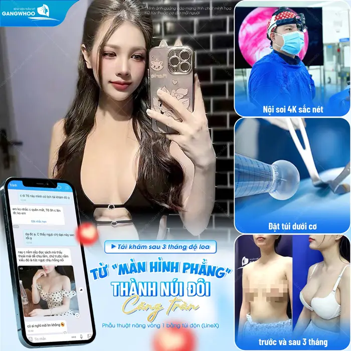 Từ "màn hình phẳng" hóa núi đôi căng tràn đẹp chuẩn sang tự tin khoe dáng đẹp quyến rũ