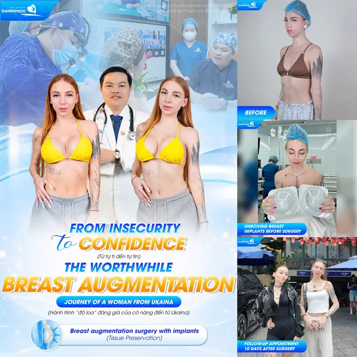 Nâng Ngực Ở Đâu Uy Tín? Top 10 Địa Chỉ Tại TPHCM 3 Body đẹp quyến rũ nhan sắc đẹp thăng hạng từ tự ti đến tự tin lựa chọn của khách hàng đến từ Ukraina
