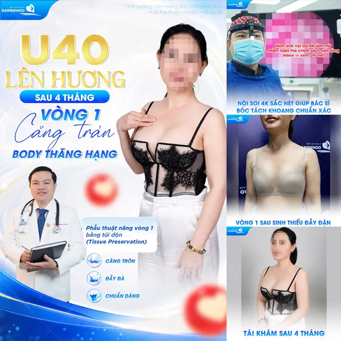 3+ Phương Pháp Nâng Ngực Tự Nhiên Không Phẫu Thuật Chuẩn Hàn 3 U40 lên hương đẹp chấn động sau 4 tháng nâng cấp vòng 1 bằng túi độn