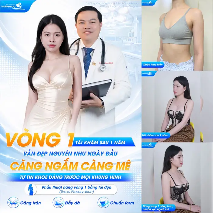 Nâng vòng 1 nội soi tái khám sau 1 năm ngày càng đẹp mặn mà và quyến rũ theo thời gian