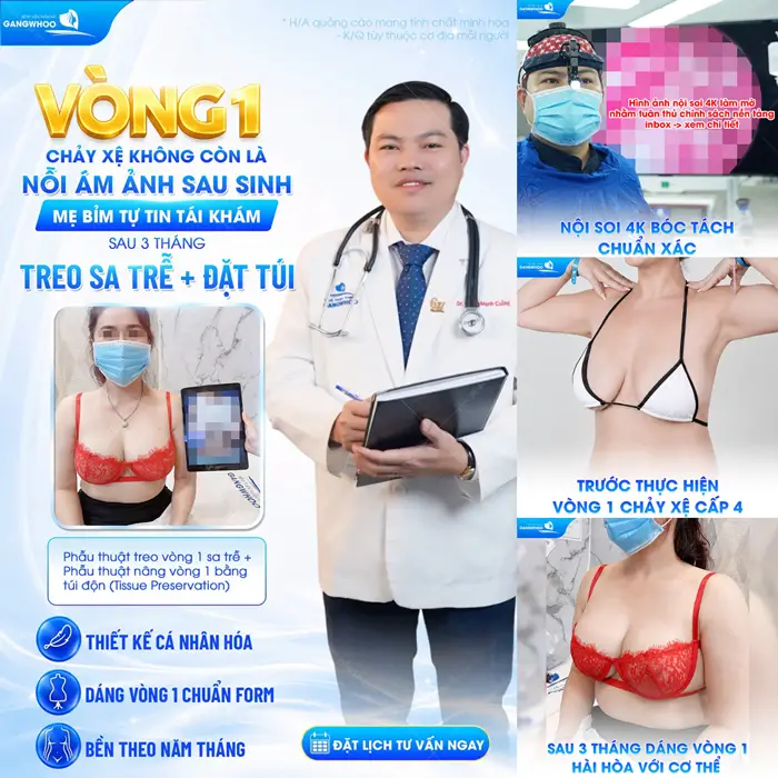 Vòng 1 chảy xệ không còn là nỗi ám ảnh sau sinh của mẹ bỉm sau 3 tháng treo sa trễ và đặt túi 