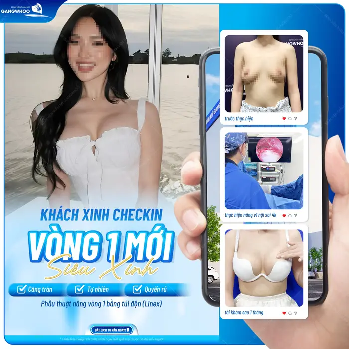 Nâng Ngực Nội Soi Ở Đâu Tốt? 10 Địa Chỉ Tốt Ở TPHCM 17 Phẫu thuật nâng vòng 1 bằng túi độn vòng 1 mới siêu xinh tôn đường cong quyến rũ cho vóc dáng