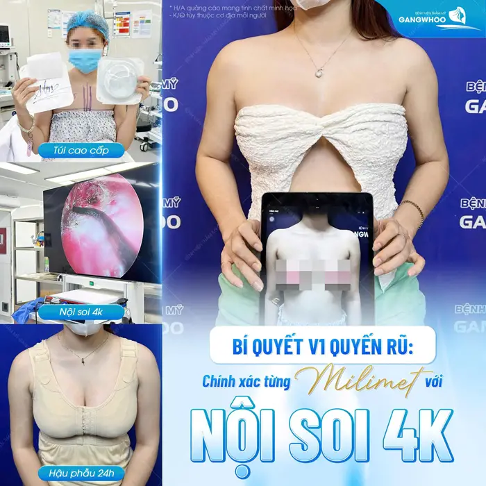 Bí quyết vòng 1 quyến rũ chính xác từng Milimet với công nghệ nội soi hiện đại 