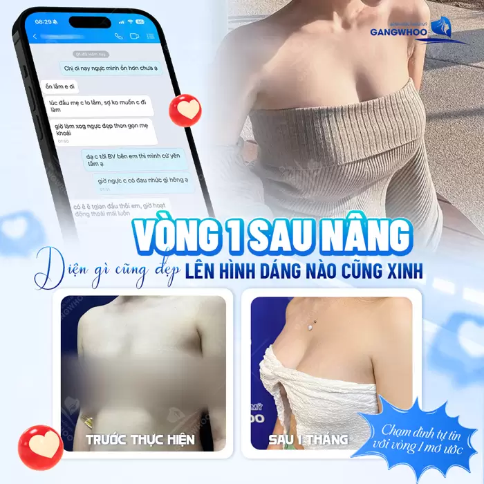 6+ Cách Làm Cho Ngực To Hơn Ở Tuổi Dậy Thì Tại Nhà 1 Vòng 1 sau nâng diện gì cũng đẹp lên hình dáng nào cũng xinh đầy quyến rũ