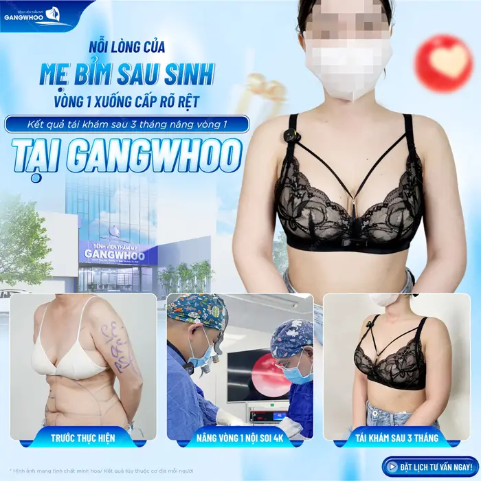 Vòng 1 chảy xệ sau sinh kết quả thay đổi đầy bất ngờ sau 3 tháng tái khám