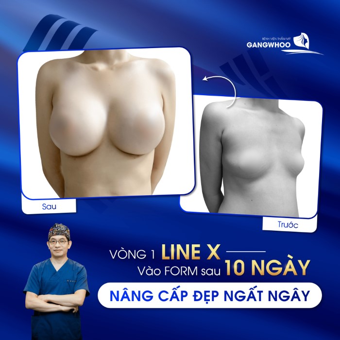 ĐẠI LỄ 2/9 ĐI CHƠI HAY ĐI LÀM ĐẸP? 14 Ảnh khách hàng thẩm mỹ tại BVTM Gangwhoo