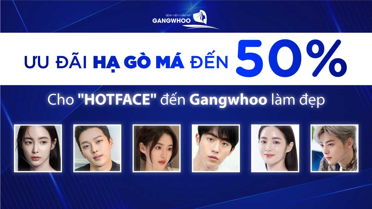Phẫu thuật hạ gò má - Ưu đãi đặc biệt cho "hot face"