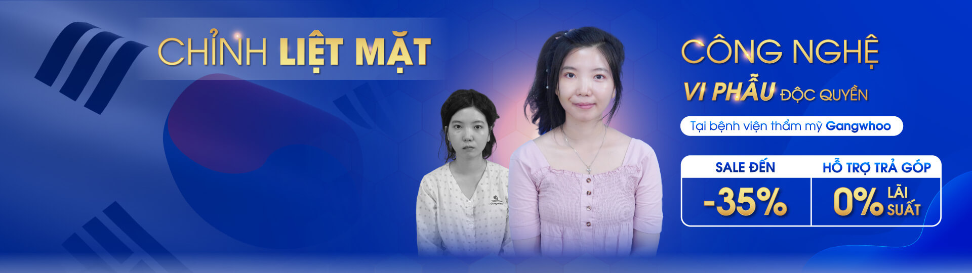 LDP liet mat 1