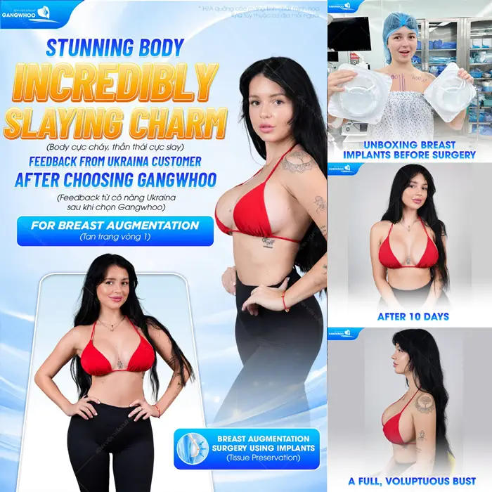 Body cực cháy thần thái cực cuốn hút, diện mạo cực slay sau phẫu thuật tôn lên body đẹp cuốn hút