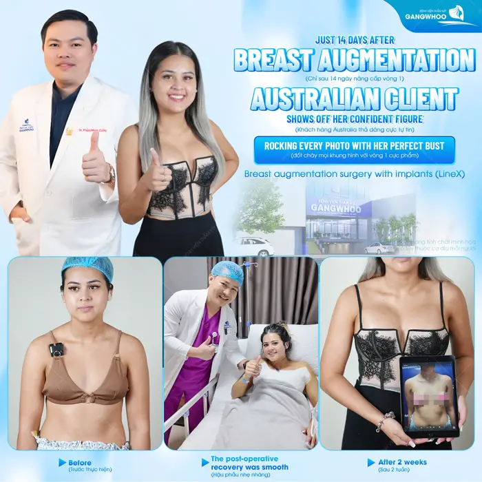 Sau 14 ngày thực hiện nữ khách hàng đến từ Úc đã trở nên tự tin hơn với diện mạo của mình