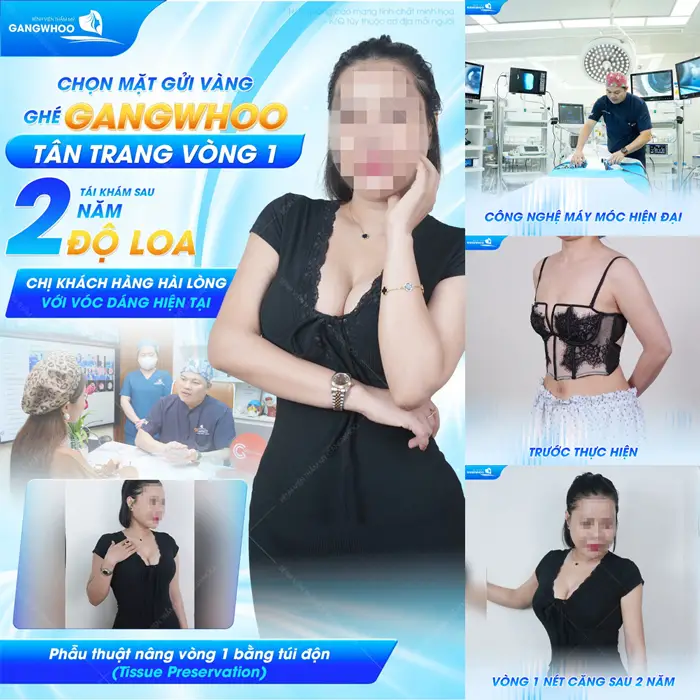 Chọn mặt gửi vàng tân trang vòng 1 sau 2 năm độ loa chị khách hàng lòng với sắc vóc hiện đại