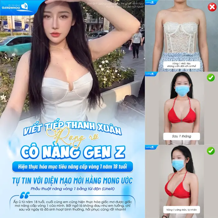 Nâng Ngực Giọt Nước Là Gì? Tại Sao Được Nhiều Người Lựa Chọn? 6 Nâng cấp vòng 1 diện mạo căng đẹp quyến rũ với diện mạo thêm cuốn hút và rạng rỡ