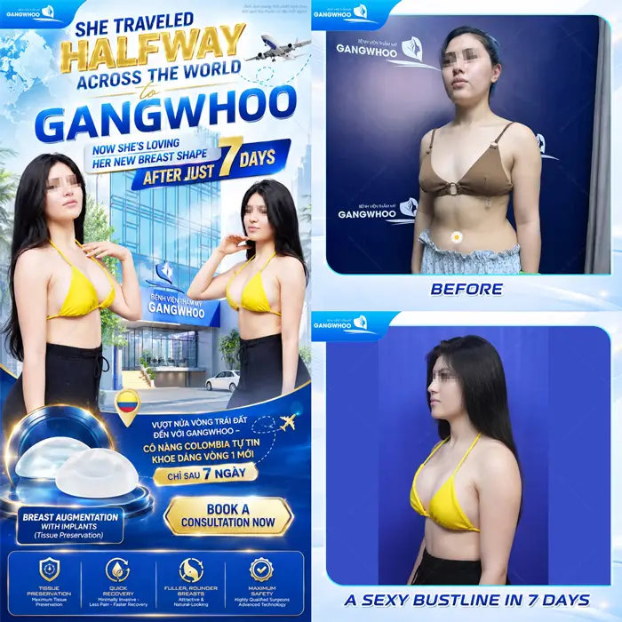 Sau 7 ngày tôn lên đường cong quyến rũ lựa chọn của khách hàng quốc tế