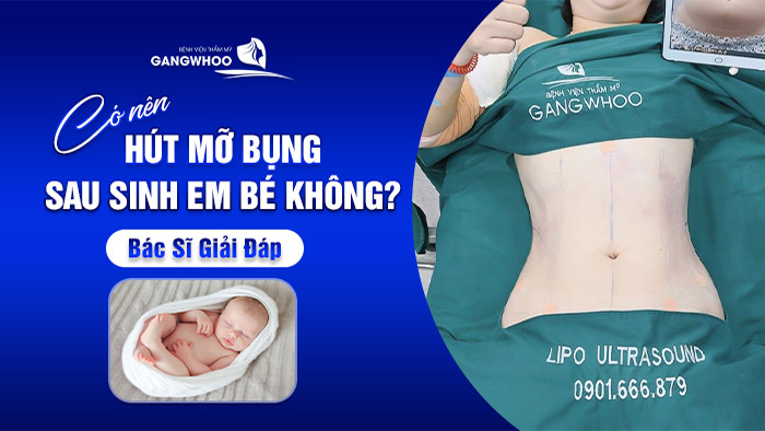 co nen hut mo bung sau sinh em be khong