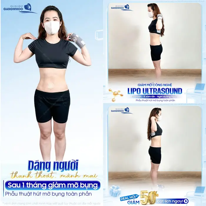 Dáng người thanh thoát và mảnh mai sau 1 tháng giảm mỡ bụng toàn phần tự tin khoe eo thon phẳng nuột 