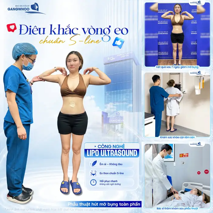 Điêu khắc vòng eo chuẩn S Line với công nghệ hút mỡ hiện đại Lipo Ultrasound