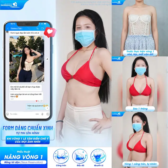 Form dáng chuẩn xinh tự tin lên hình sau trùng tu vòng 1 