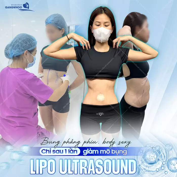 Top 10 Địa Chỉ Hút Mỡ Bụng Ở Đà Nẵng Uy Tín Chất Lượng 2 Chỉ sau 1 lần thực hiện hút mỡ bụng tự tin khoe eo thon phẳng phiu, body quyến rũ siêu sexy
