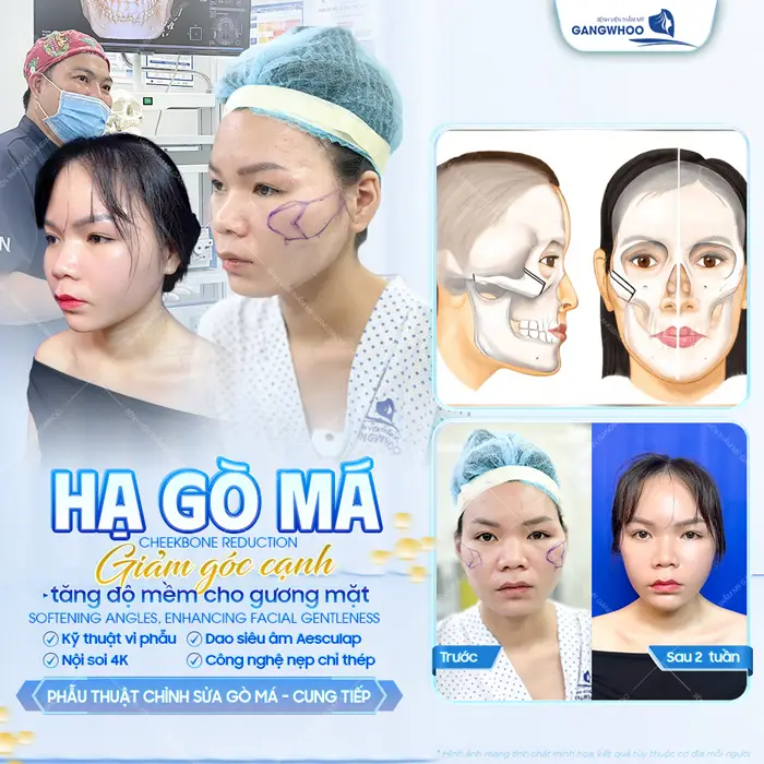 Góc cằm thon gọn, mềm mại và tự nhiên tôn lên đường nét hài hòa cho diện mạo tổng thể