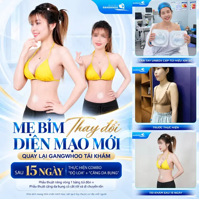 Mẹ bỉm thay đổi diện mạo mới đẹp quyến rũ và căng đầy hấp dẫn sau 15 ngày nâng cấp vòng 1