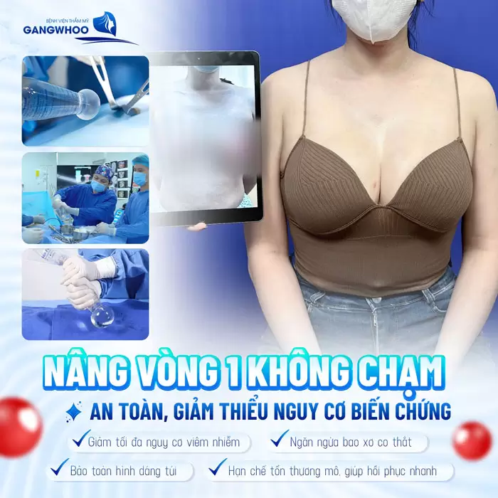 Nâng Ngực Nội Soi Có An Toàn Không? 5 Lưu ý Đảm Bảo An Toàn 1 Nâng vòng 1 không chạm tại Gangwhoo an toàn, giảm thiểu nguy cơ biến chứng