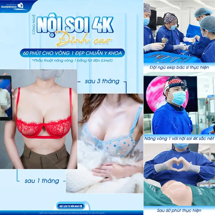 60 phút cho vòng 1 đẹp chuẩn y khoa tôn tạo nét đẹp đỉnh cao đầy cuốn hút