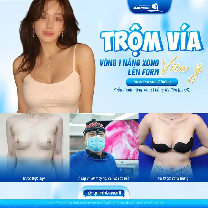 Vòng 1 lên form đẹp chuẩn tỷ lệ tôn tạo nét đẹp quyến rũ cho phái đẹp