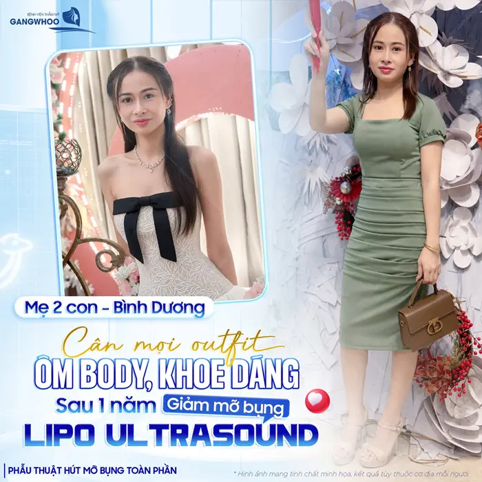 Cân mọi outfit sau 1 năm giảm mỡ bụng Lipo Ultrasound mẹ 2 con ngày càng thăng hạng và tự tin khoe sắc vóc đẹp rạng rỡ