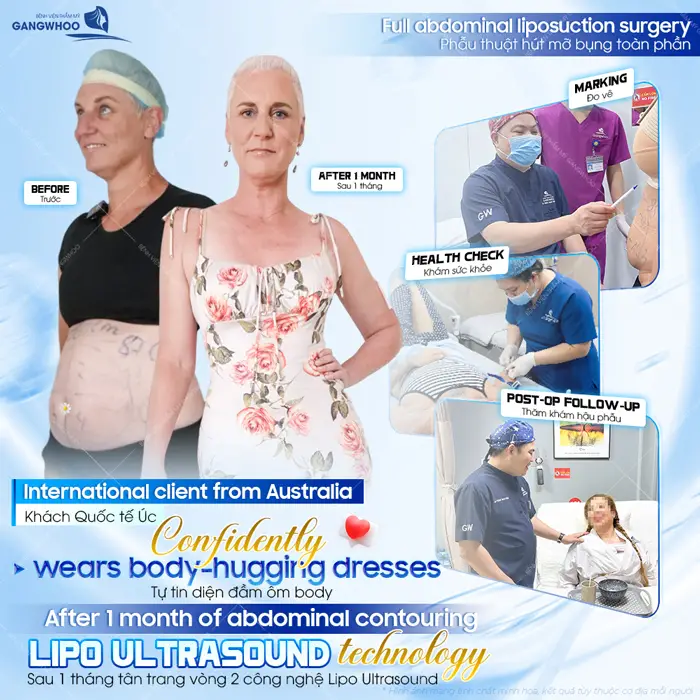 Khách quốc tế Úc tự tin diện đầm body khoe sắc siêu quyến rũ nâng tầm diện mạo sau 1 tháng đã đẹp chuẩn model 