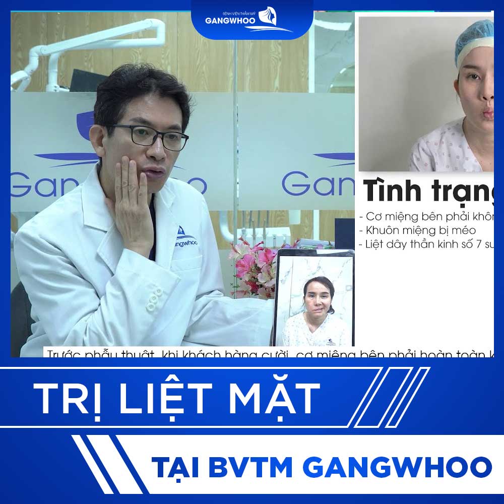 video tri liet mat 5