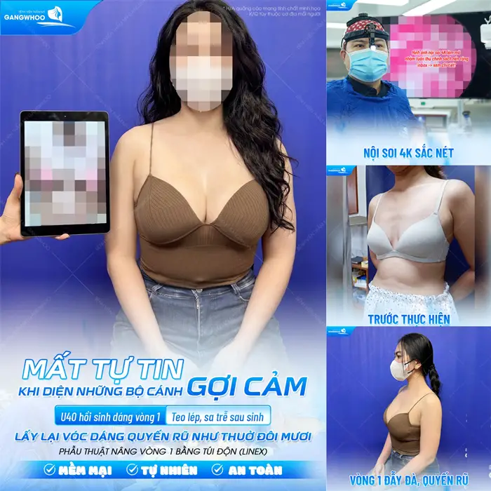 Vòng 1 đẹp căng tràn và xuất sắc sau thực hiện với hệ thống công nghệ nội soi hiện đại 
