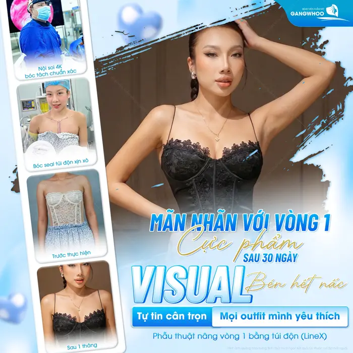 Mãn nhãn với vòng 1 cực phẩm sau 30 ngày visual đã đẹp thăng hạng cân đẹp mọi outfit yêu thích