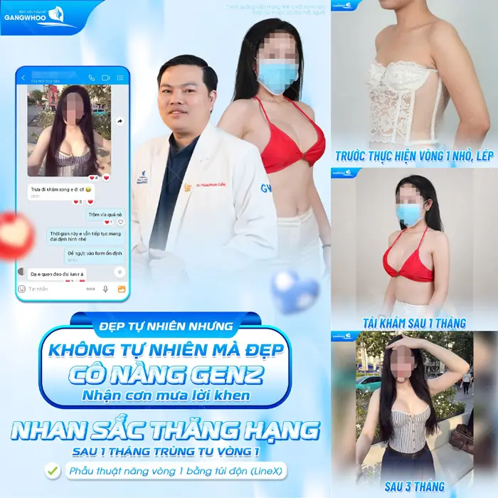 Nâng Ngực Nội Soi Có An Toàn Không? 5 Lưu ý Đảm Bảo An Toàn 4 Nhan sắc thăng hạng sau 1 tháng trùng tu vòng 1 đẹp tự nhiên với vòng 1 quyến rũ và mềm mại