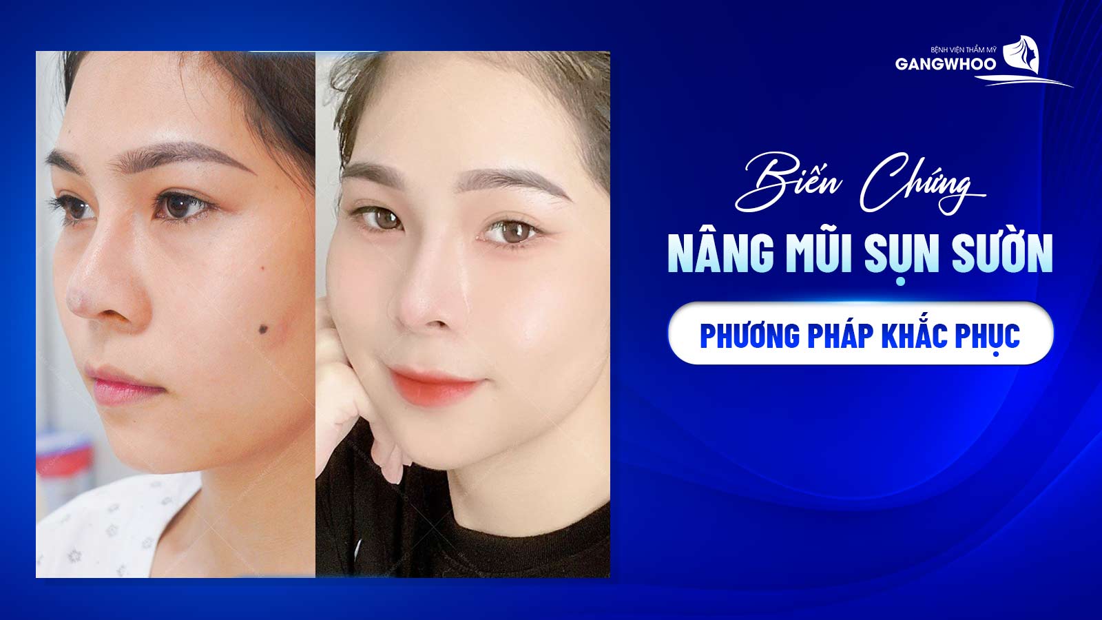 Bien Chung Nang Mui Sun Suon 1
