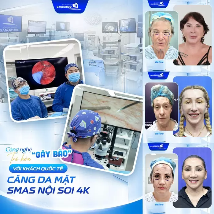 Giới Thiệu Bệnh Viện Thẩm Mỹ Gangwhoo - Bệnh viện Chuẩn Hàn 12 cang da mat smas tre hoa lan da an toan hieu qua duoc kh quoc te tin tuong