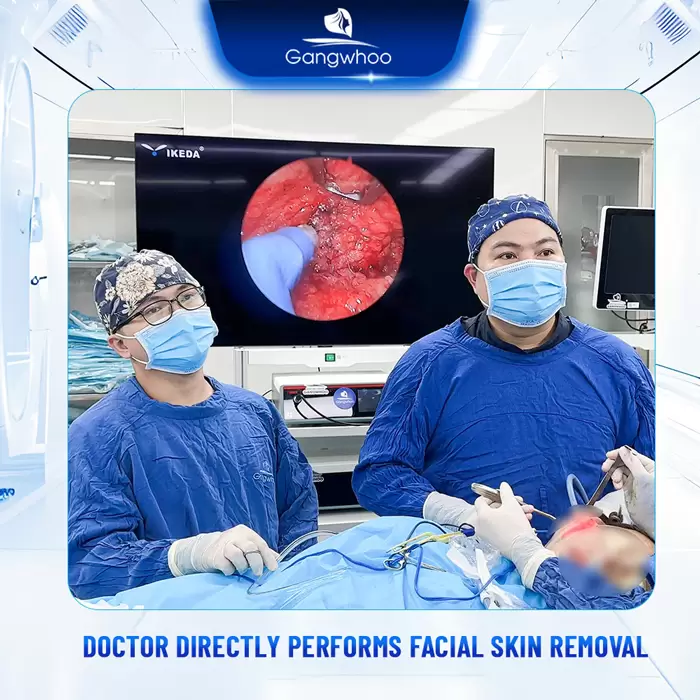 cat da thua vung mat en 10