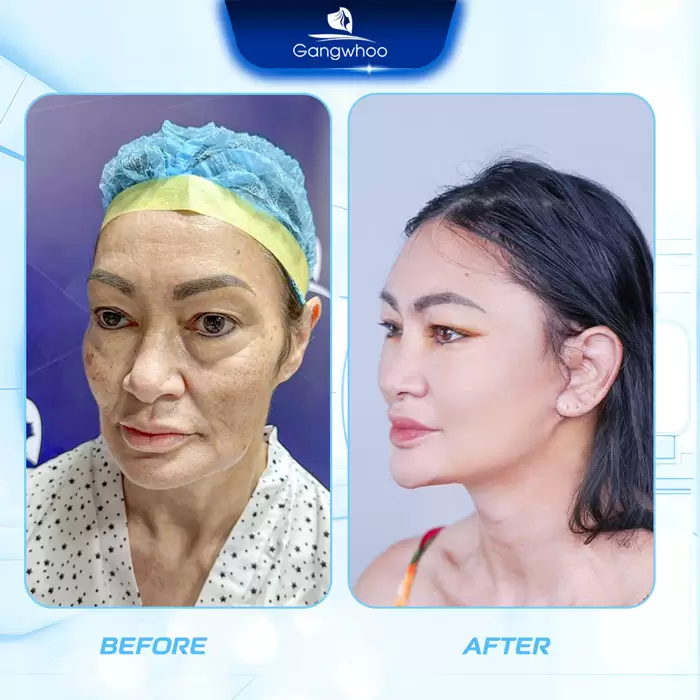 cat da thua vung mat en 3