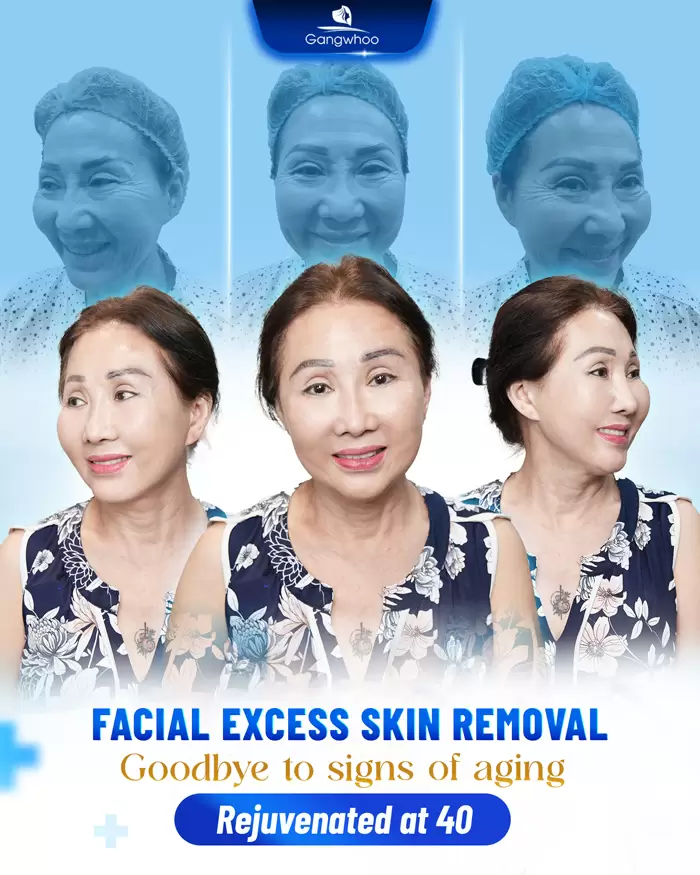 cat da thua vung mat en 4