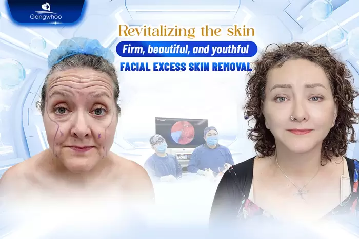 cat da thua vung mat en 7