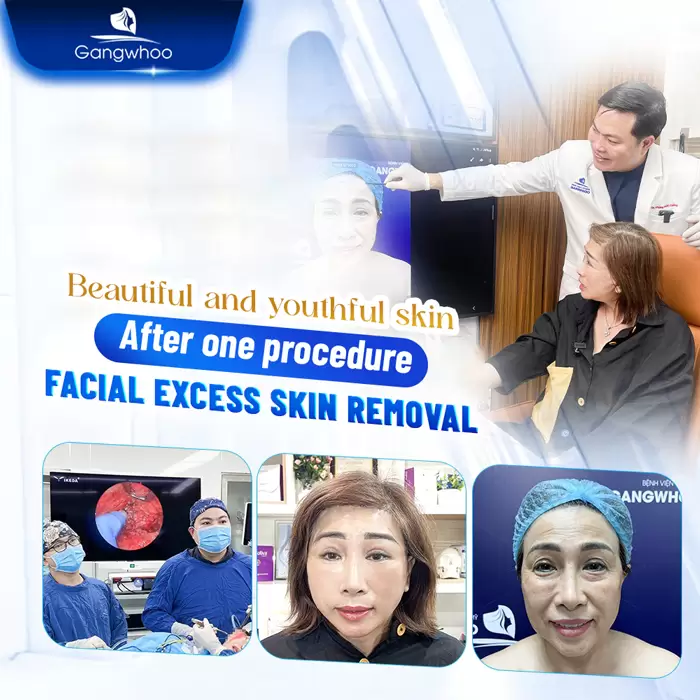 cat da thua vung mat en 9