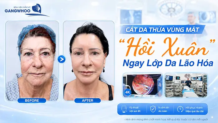 cat da thua vung mat vn 1