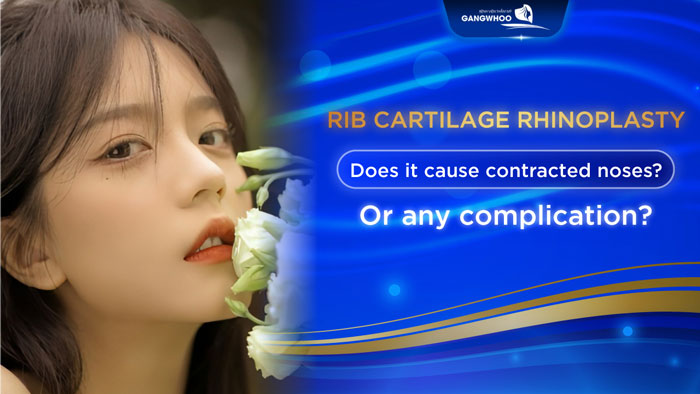 Contracted Nose After Rib Cartilage Rhinoplasty 