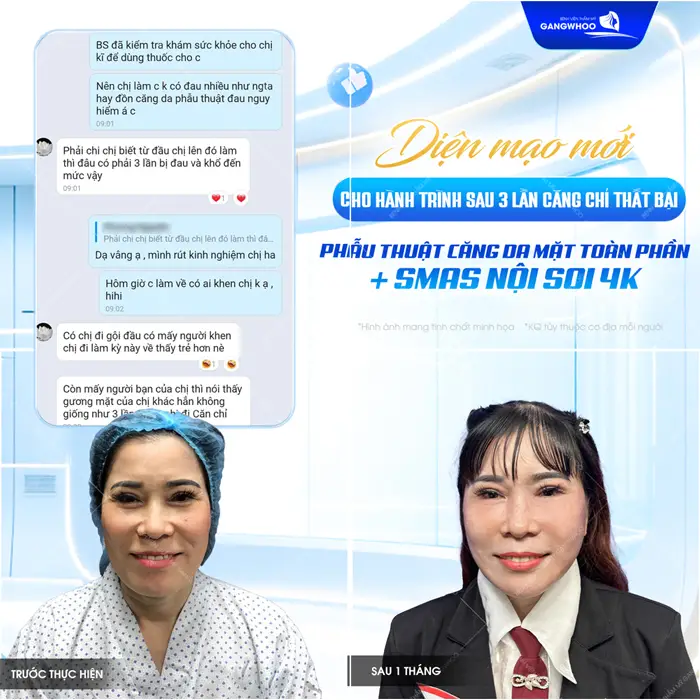 dien maoo moi cho hanh trinh sau 3 lan cang chi khach hang chia se su hai long sau phau thuat cang da mat smas noi soi 4k