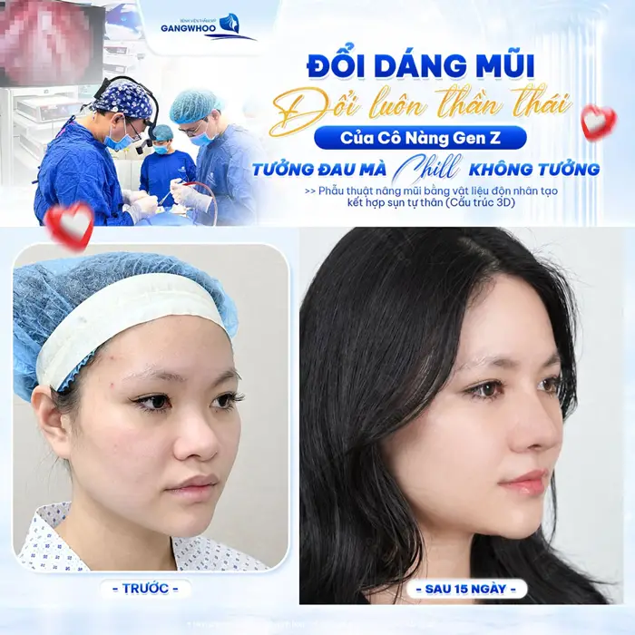 Đối dang mũi đổi luôn thần thái của cô nàng GenZ tưởng đau mà Chill không tưởng 