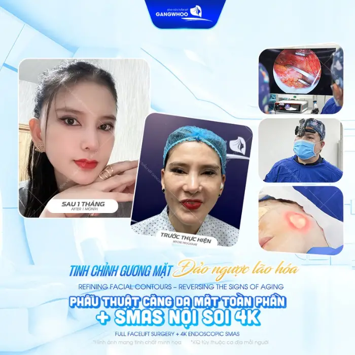 facial excess skin removal 2