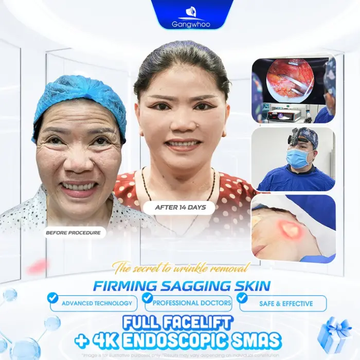 facial excess skin removal