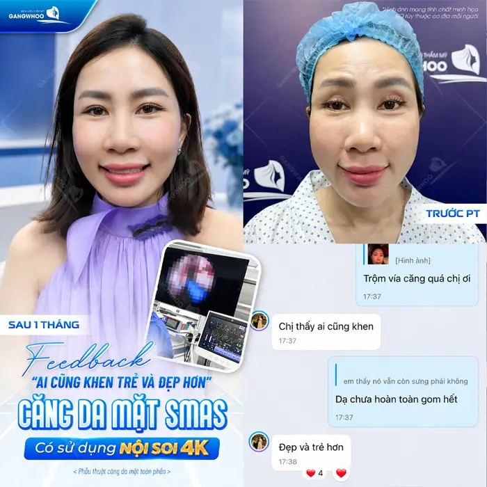 fb cang da mat co su dung noi soi 4k