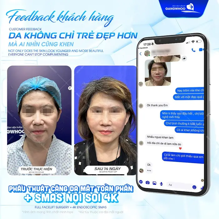 fb cua khach hang sau phau thuat cang da mat chia se