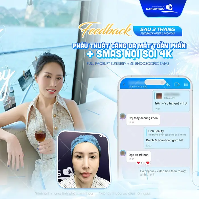 fb kh cang da mat smas toan phan