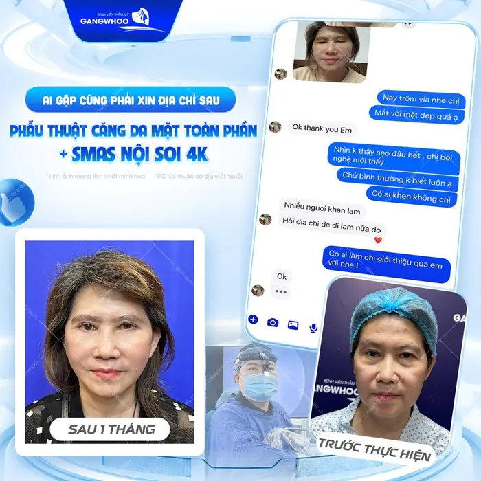 fb khach hang sau 1 thang cang da mat dien mao va nhan sac dep thang hang va tre trung hon thay ro